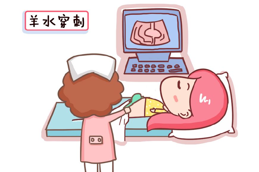 汉中华西妇产医院|羊水穿刺可测胎儿畸形？