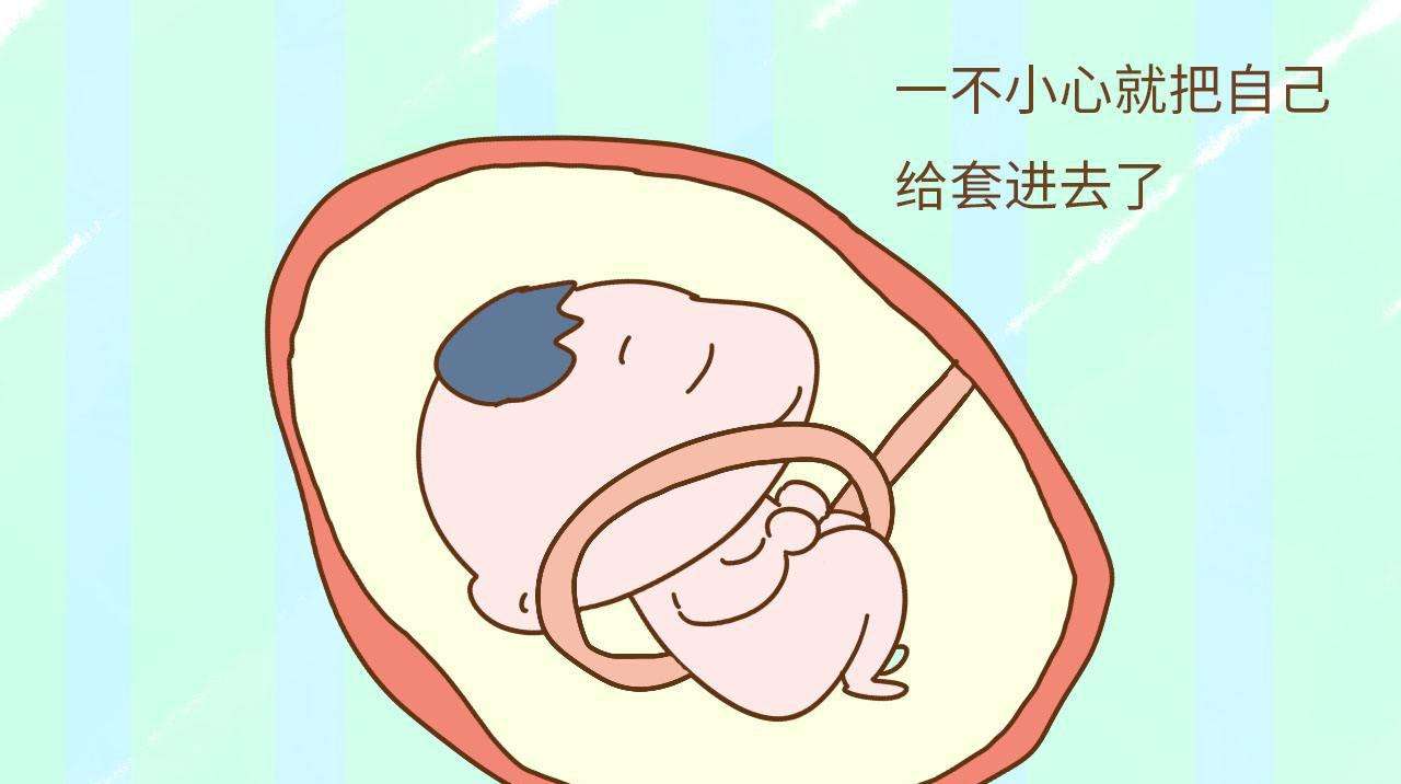 汉中华西妇产医院|宝宝脐带绕颈总觉得喘，孕妈该怎么做?