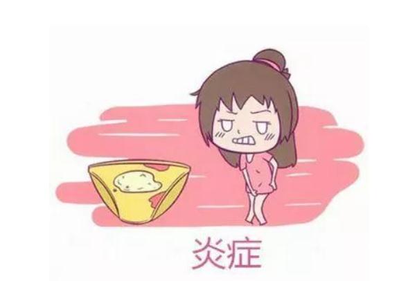汉中华西妇产医院|乳凝状白带不痒什么原因？