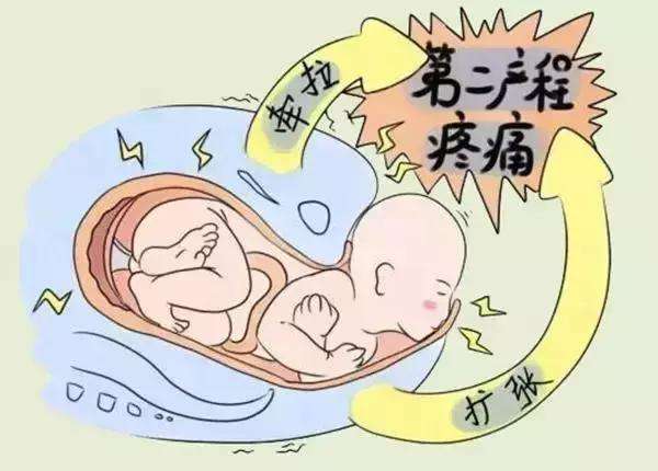 汉中华西妇产医院|无痛分娩真的没有疼痛感嘛？